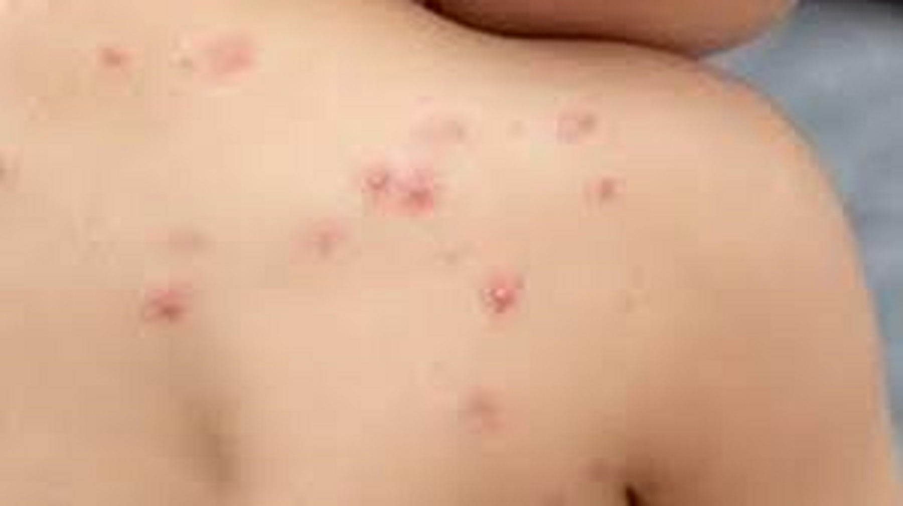 Imagen archivo cortesía de referencia