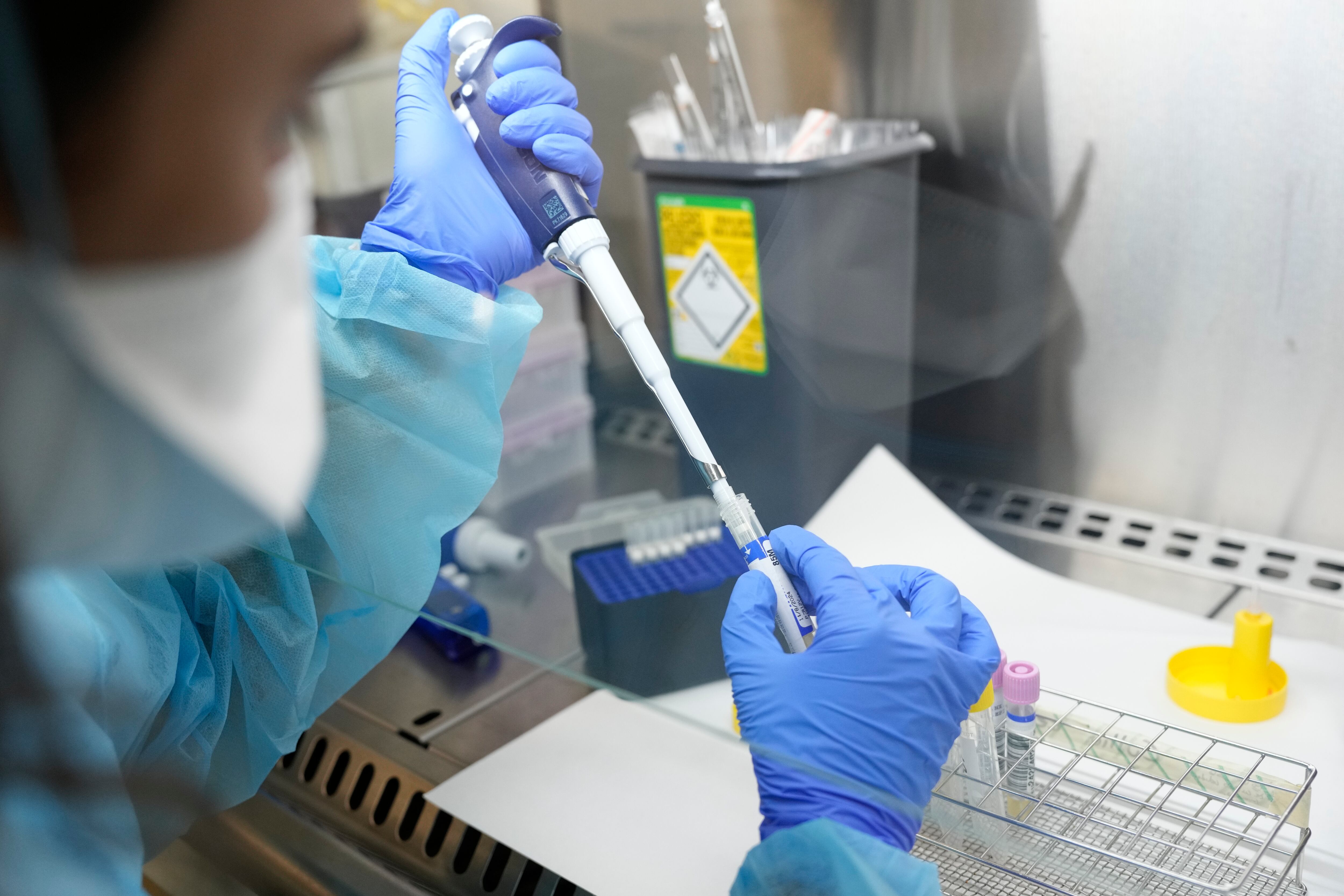 Este año van dos pacientes de Viruela Símica, pero no se han confirmado nuevos casos