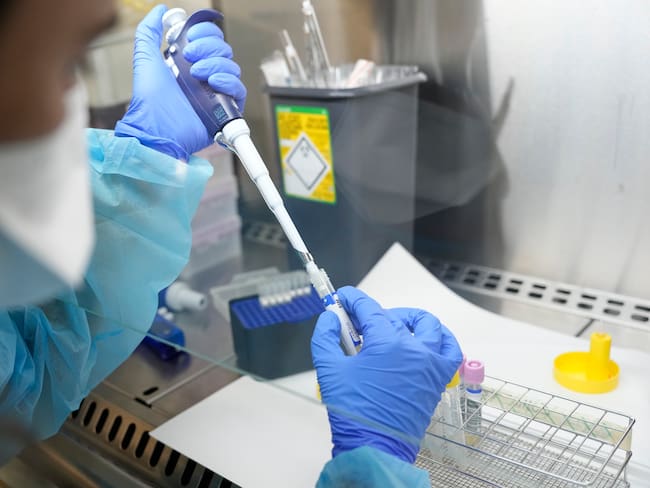 Este año van dos pacientes de Viruela Símica, pero no se han confirmado nuevos casos