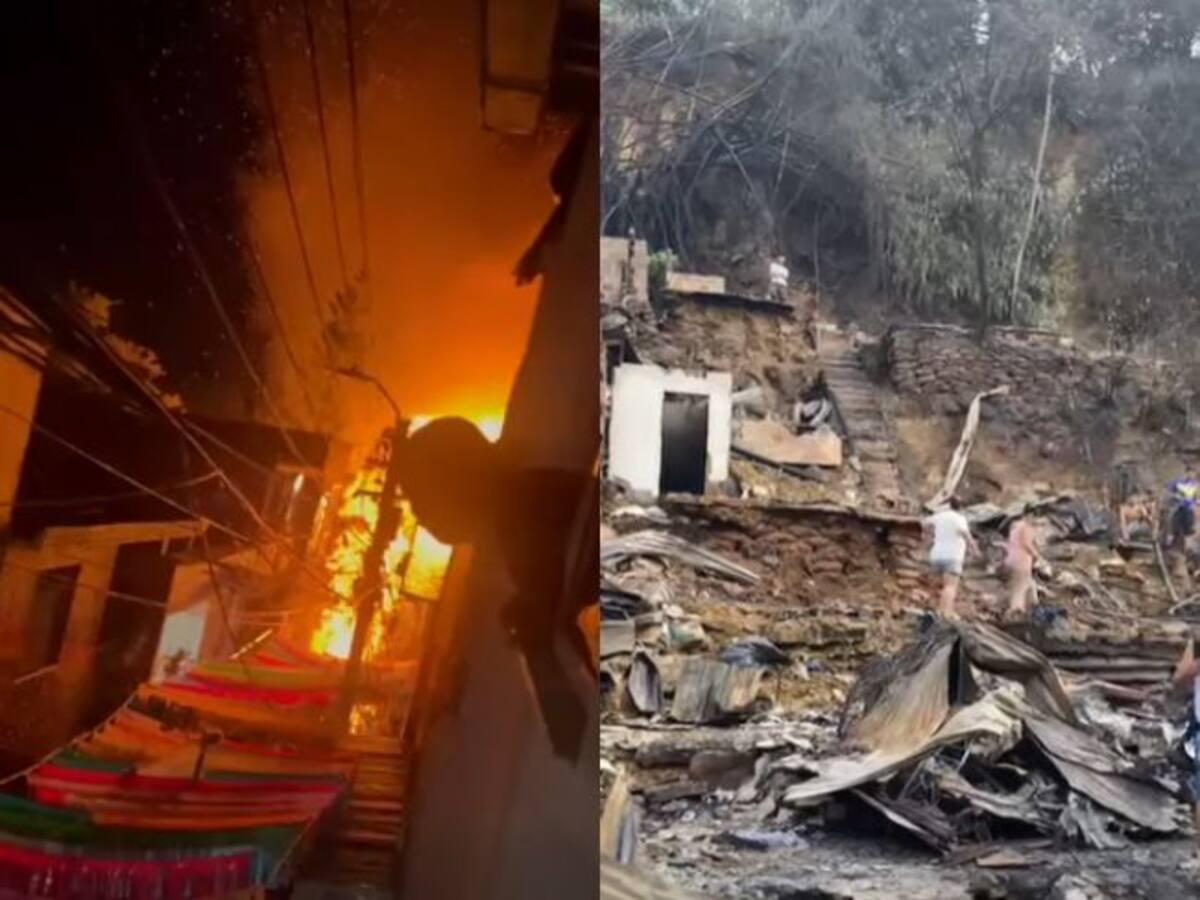 Le amputaron un brazo: ciudadano sobre persona quemada en incendio del 12 de octubre en Bucaramanga