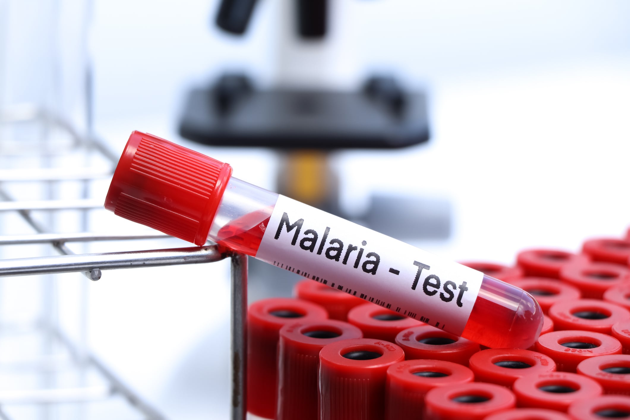 Diferencias de la malaria y el dengue, imagen de referencia. Foto: Getty Images