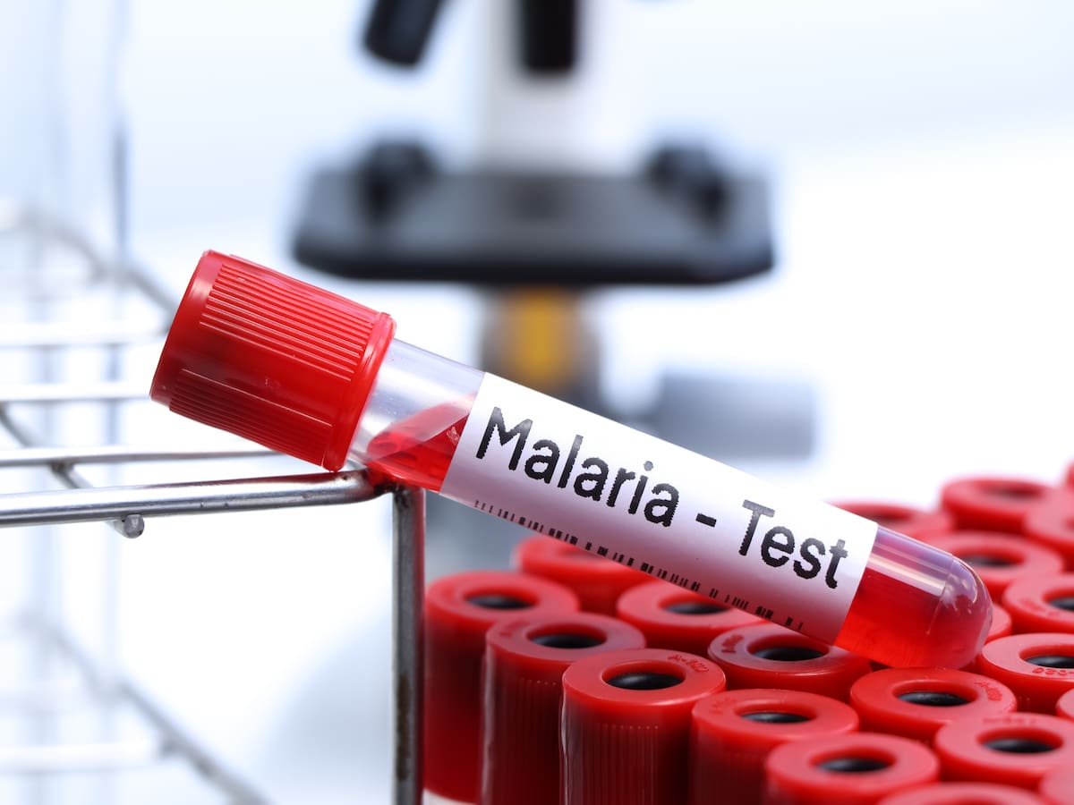 Clínicas y Hospitales implementarán una nueva prueba que permitirá prevenir recaídas por malaria