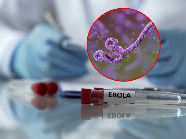 ¿Qué es el ébola y cómo se transmite? Explicación de nueva alerta internacional por brote en África. Getty Images