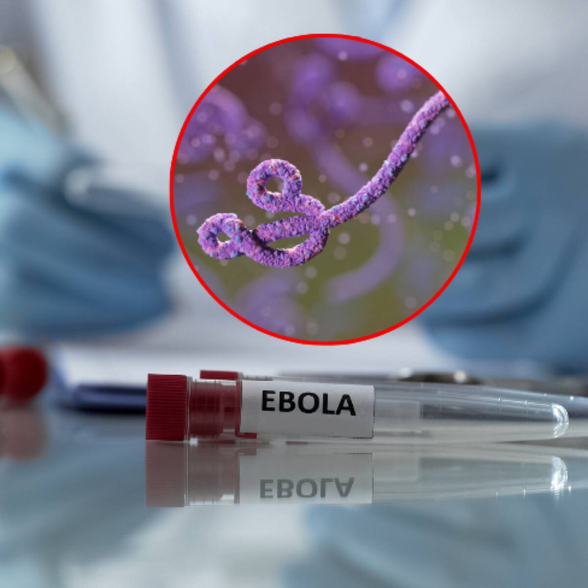Epidemia de ébola no ha alcanzado su pico y podría durar un año