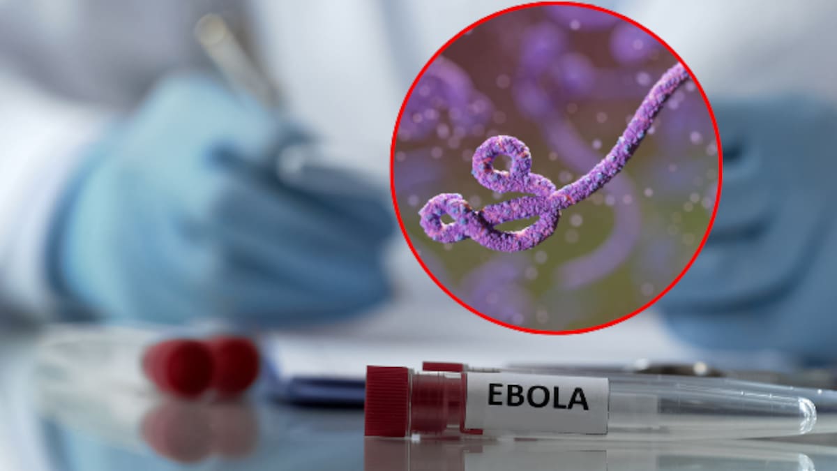 Venezuela anunció vigilancia epidemiológica por ébola en todos sus aeropuertos y puertos