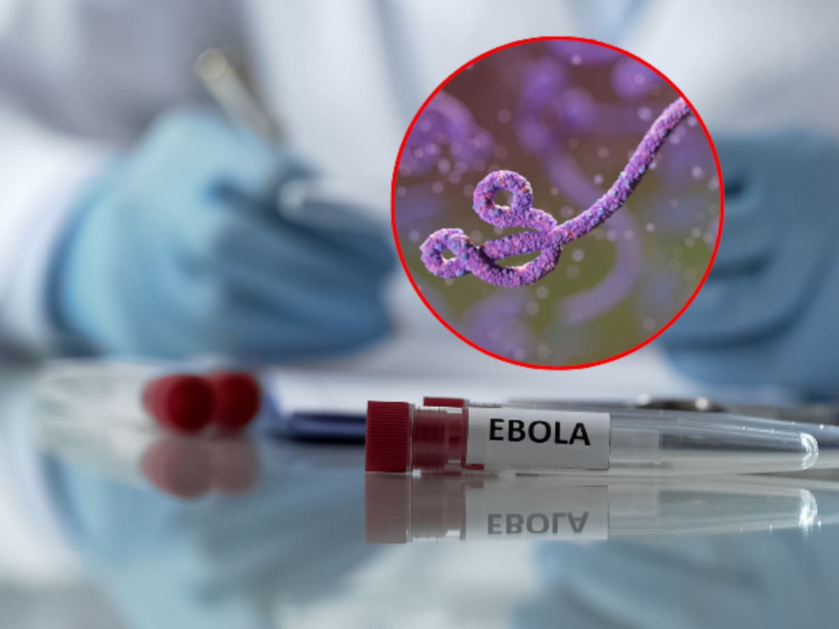 ¿Qué tan grave es el brote de ébola que causó alerta de la OMS? Así es el contagio y los síntomas