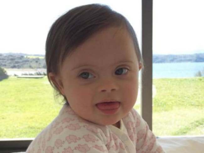 Pepita Mola, la tierna bebé con Síndrome de Down que conquistó Instagram
