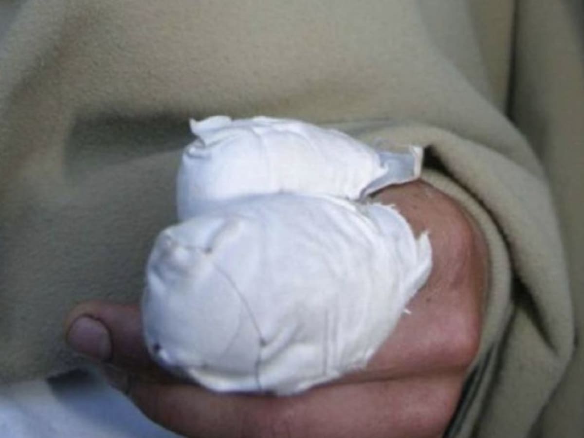 No aprenden: cuatro quemados más en Antioquia este miércoles