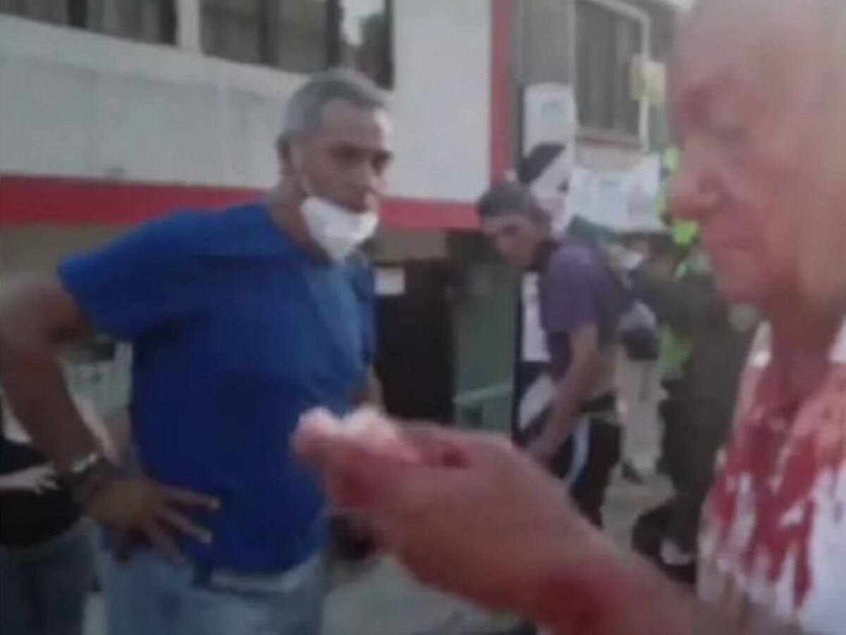 Autoridades deben poner el ojo en “limpiavidrios” en Ibagué, concejales