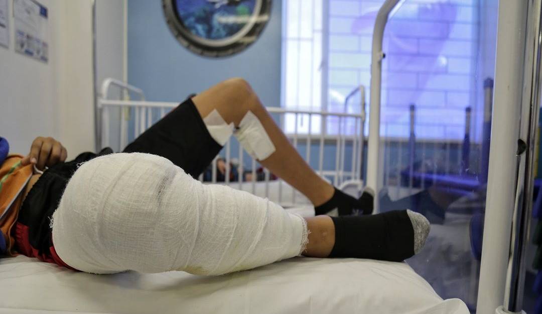 Quemados por pólvora en el departamento de Sucre.