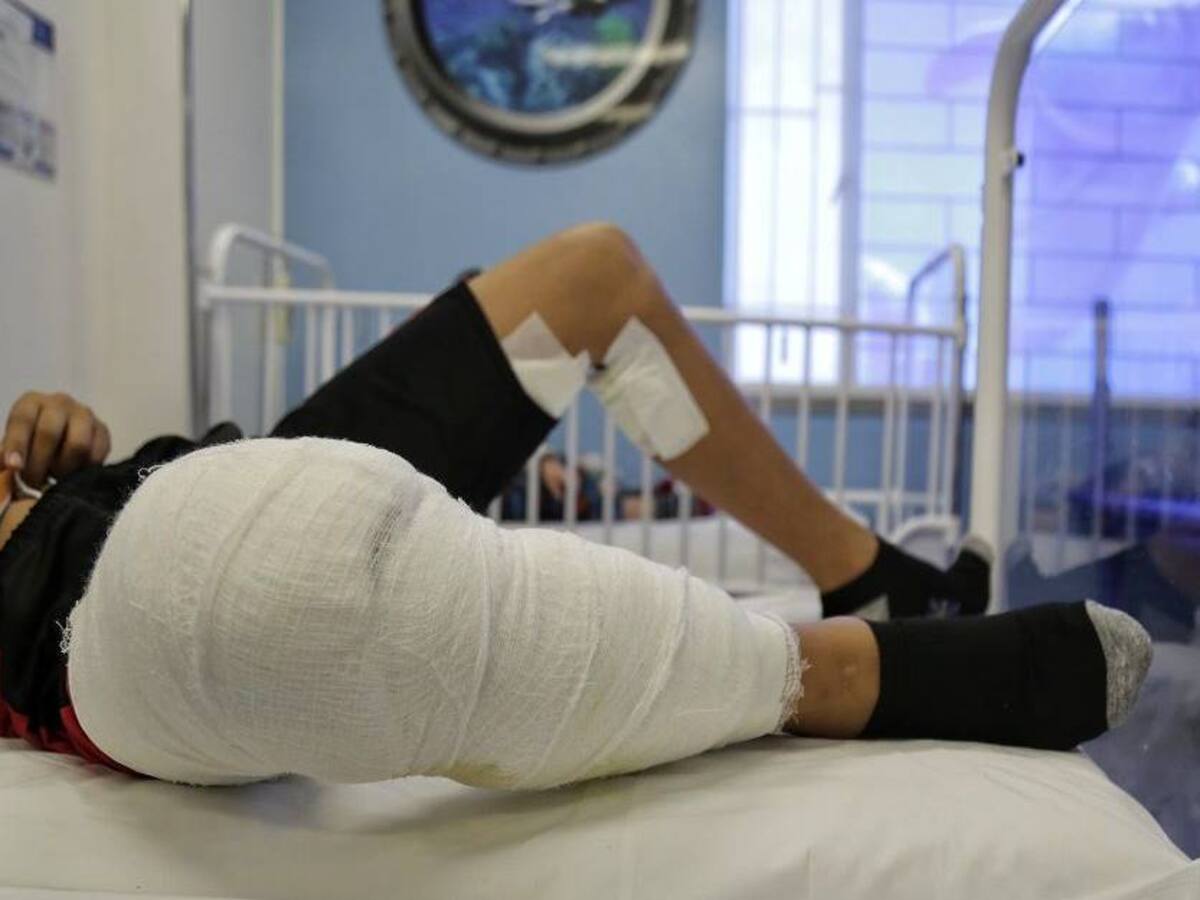 Sucre reporta un total de 12 casos por lesiones con pólvora