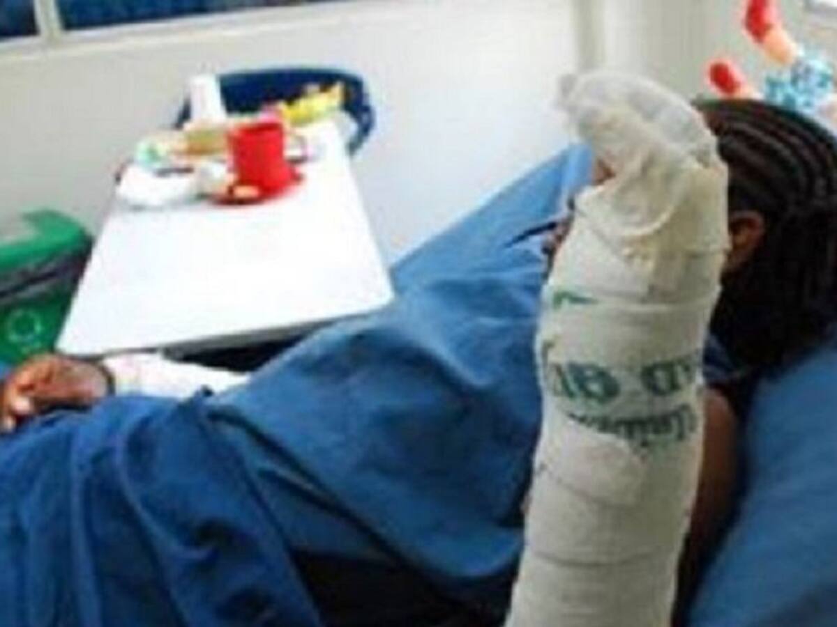 A 39 ascienden los quemados por pólvora en el Valle del Cauca