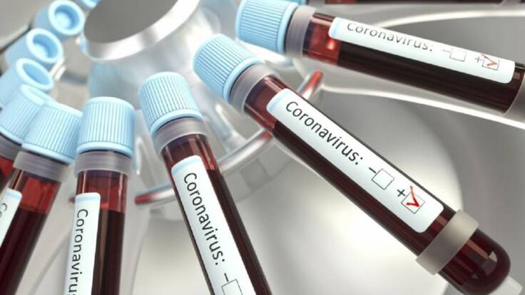 El resultado epidemiológico de Armenia demuestra disciplina social