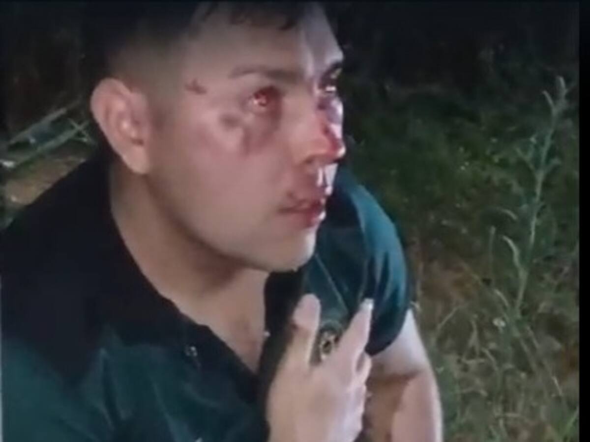 Patrullero que arrolló con su carro a una familia arrojó grado 3 en prueba de alcoholemia