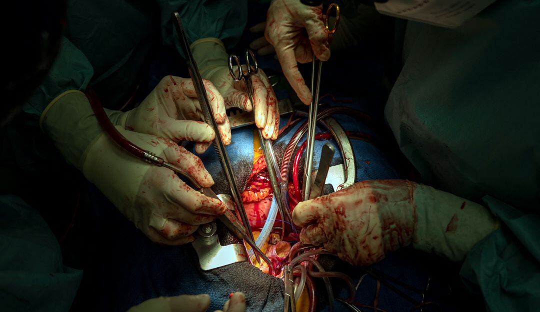 Trasplante de corazón 