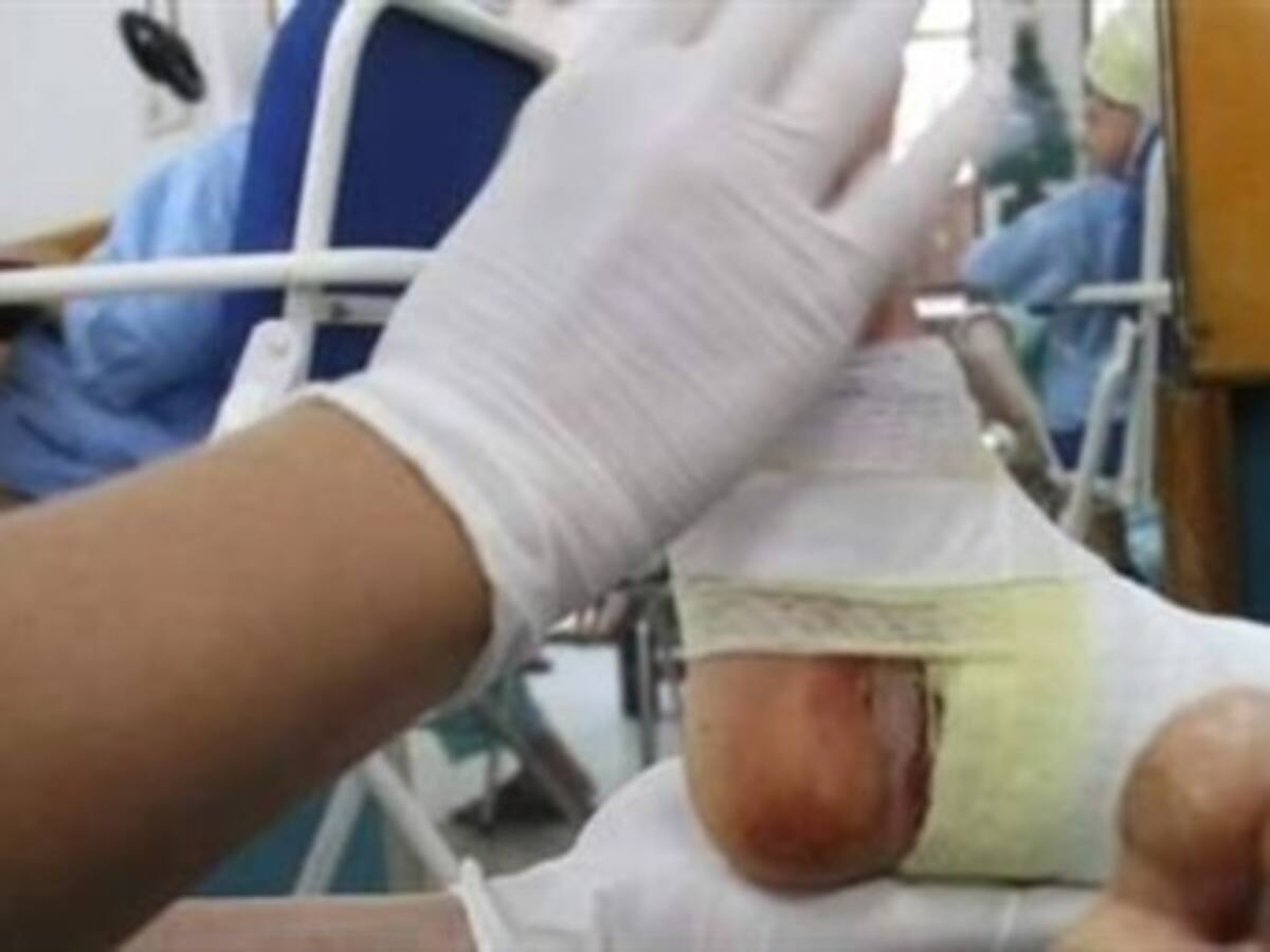 A 402 se eleva el número de personas lesionadas con pólvora en diciembre