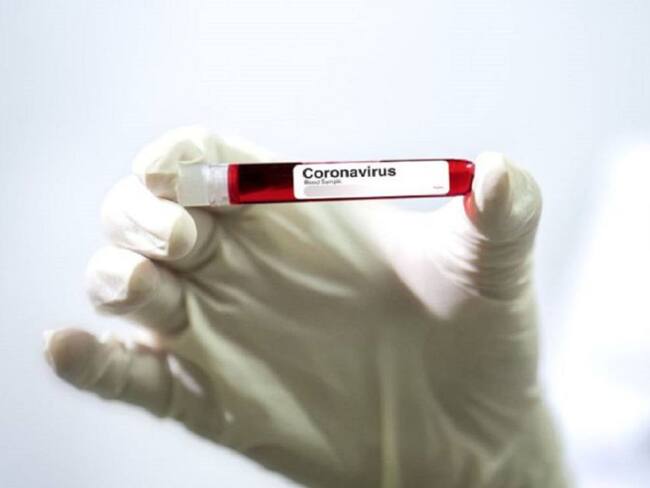 Coronavirus en Caldas