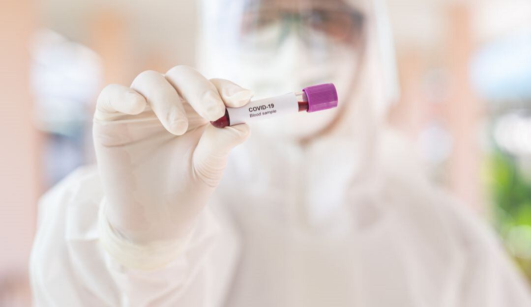 De Armenia y Montenegro son las dos personas fallecidas a causa del COVID-19 en Quindío