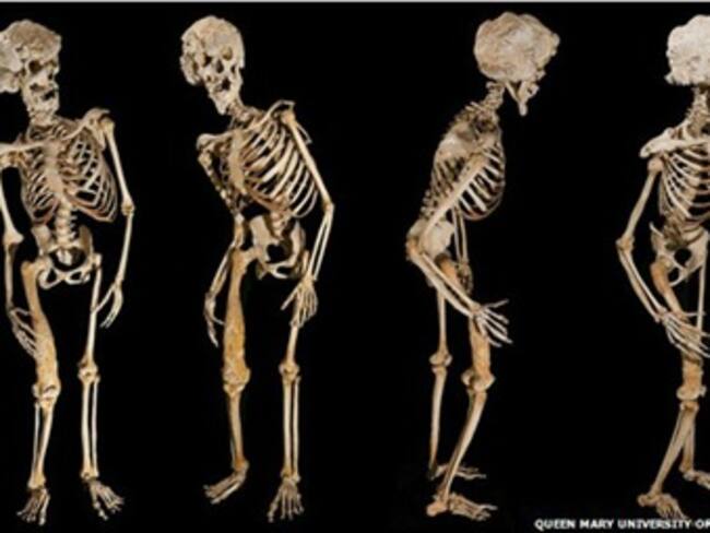 Se revelan los secretos del hombre elefante