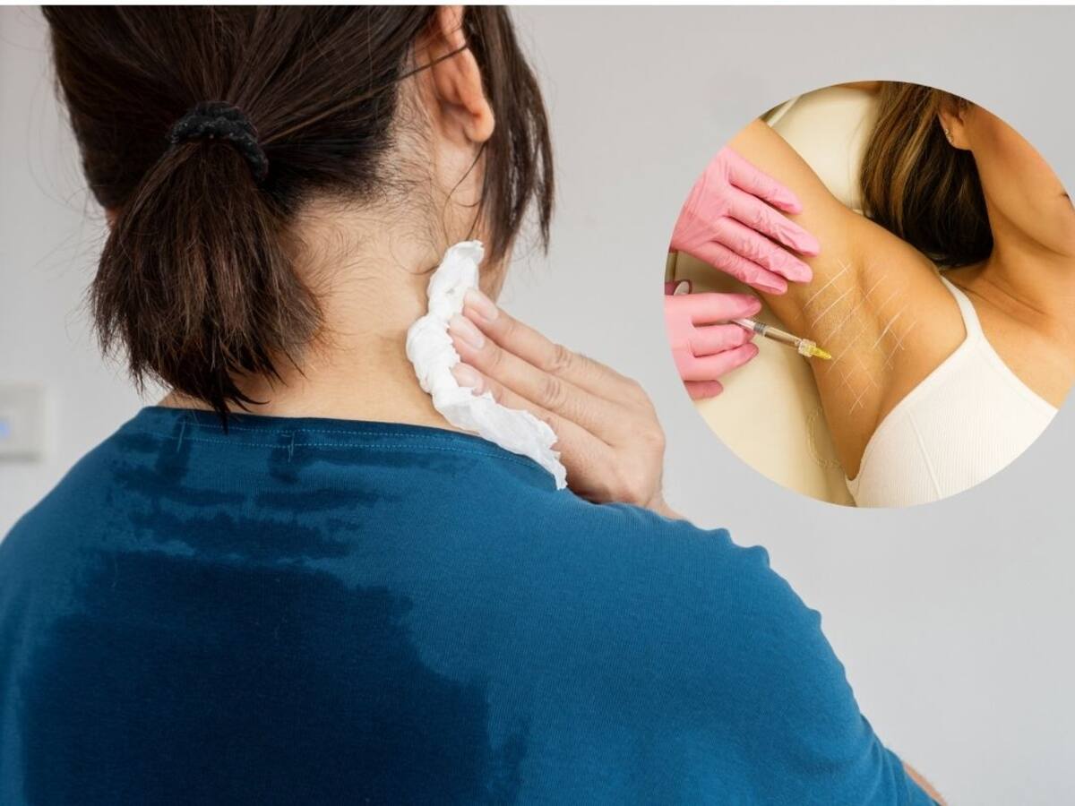 ¿Qué enfermedad te hace sudar mucho? Puede llegar a tener incapacidad laboral