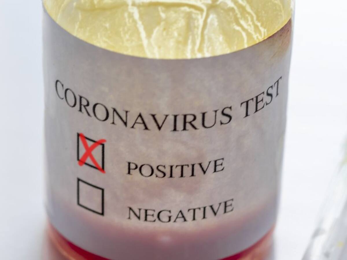 Expectativa en Venezuela por el Coronavirus