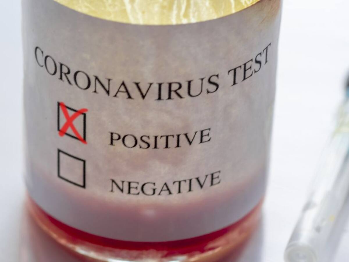 En Sucre se podrán hacer pruebas de coronavirus