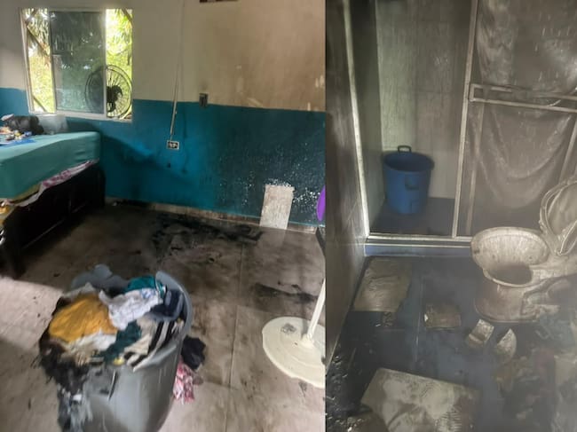 Tres niños sufren graves quemaduras tras incendio en una vivienda de Buritaca. Foto: Cortesía