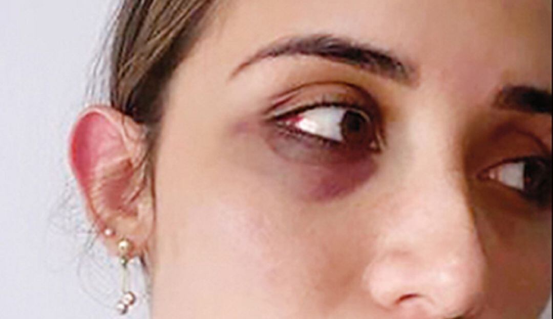 Médico acusado de agresión fue apartado de sus funciones