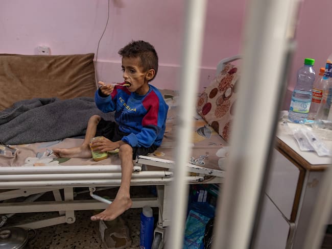 Más de 100 organizaciones internacionales advirtieron que en el territorio palestino se está propagando una “hambruna masiva”.
EFE/EPA/HAITHAM IMAD