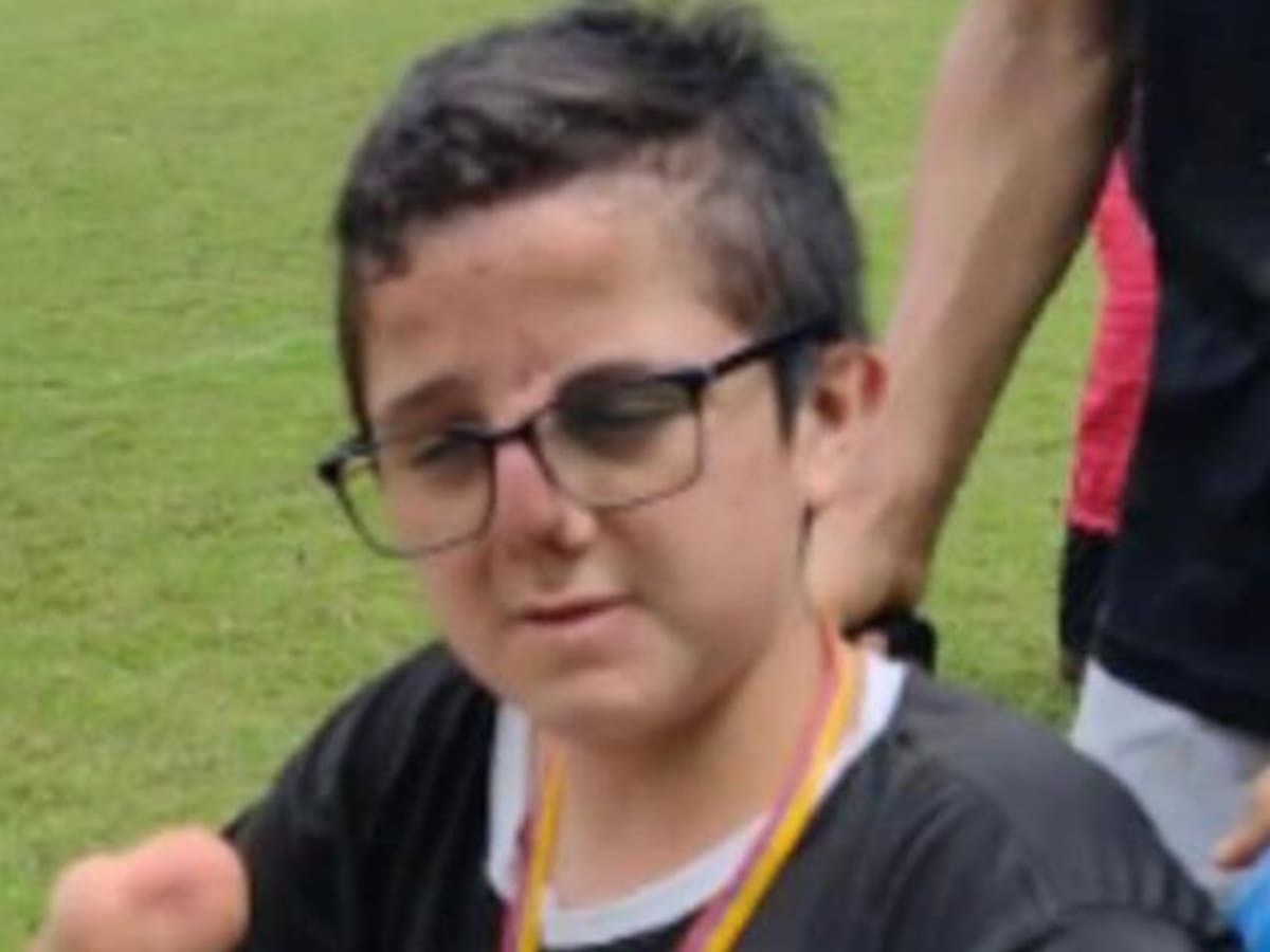 Joven en Pereira busca apoyo para adquirir la prótesis de su pierna