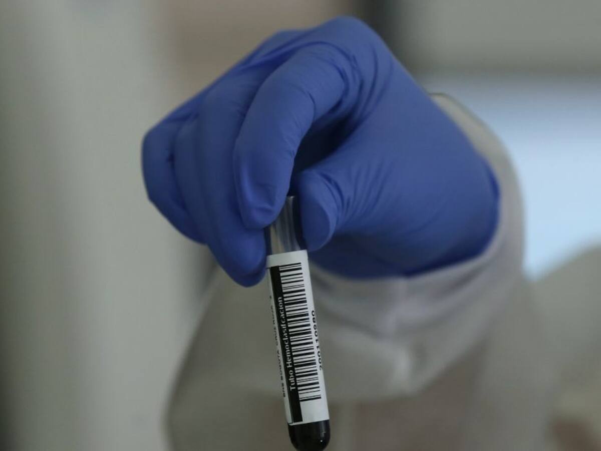 Lanzan estrategia ampliada de pruebas contra el Coronavirus en Cartagena