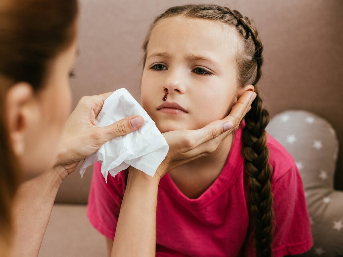 ¿Por qué es un error inclinar la cabeza hacia atrás en medio de una hemorragia nasal?