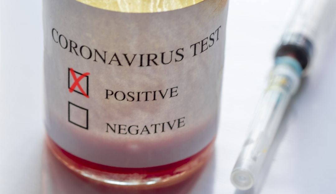 Imagen de referencia 