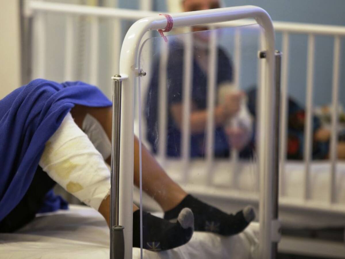 Tres menores de edad resultaron quemados en la Perimetral