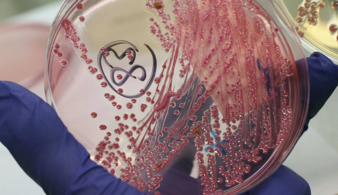 Estudio y análisis de muestras de bacterias.            Foto: Getty 