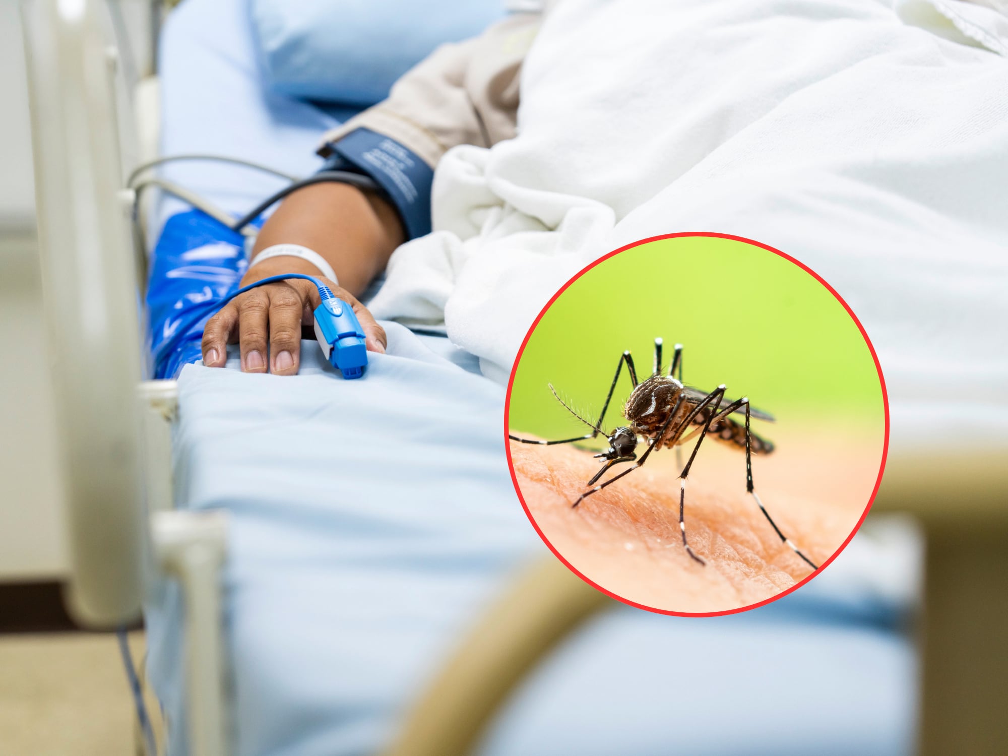 ABC fiebre amarilla. Foto: Getty Images.