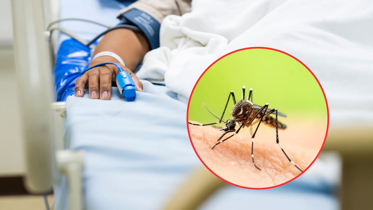 ABC Fiebre amarilla: síntomas, diagnóstico y tratamiento según el Ministerio de Salud