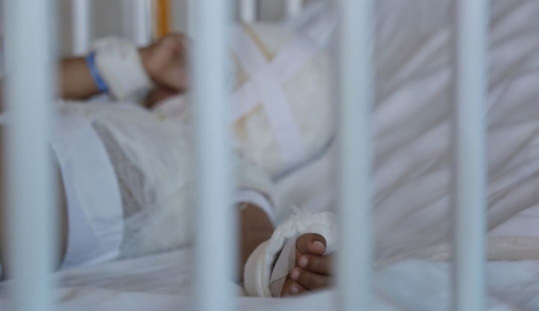 Aumentas casos de quemados con pólvora en Santander.