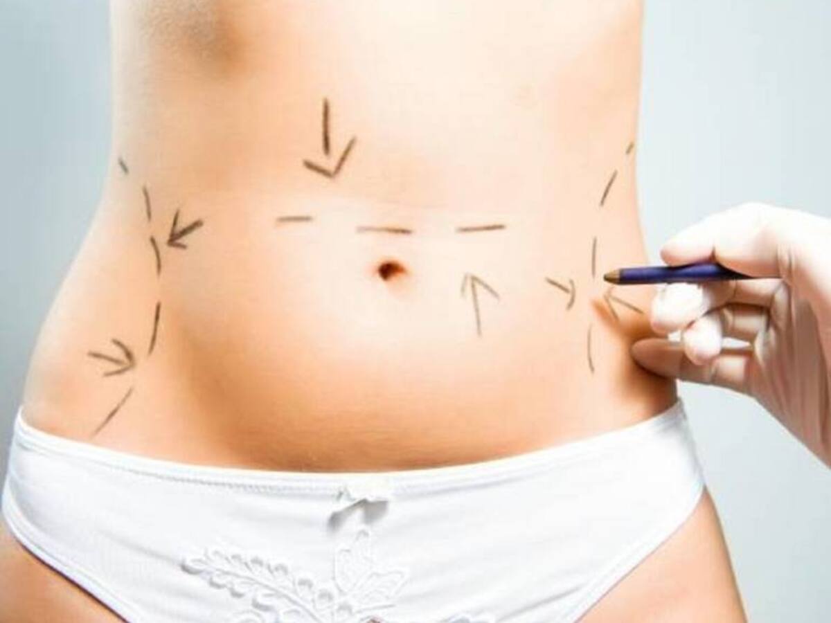 Mujer de 58 años en grave estado de salud por procedimiento estético