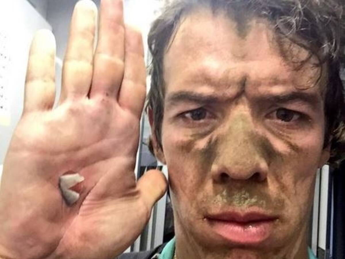 El esfuerzo de Rigo pudo más que el pavé