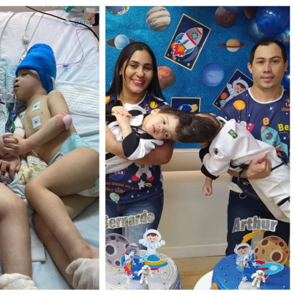 Siameses brasileños fueron separados con ayuda de realidad virtual