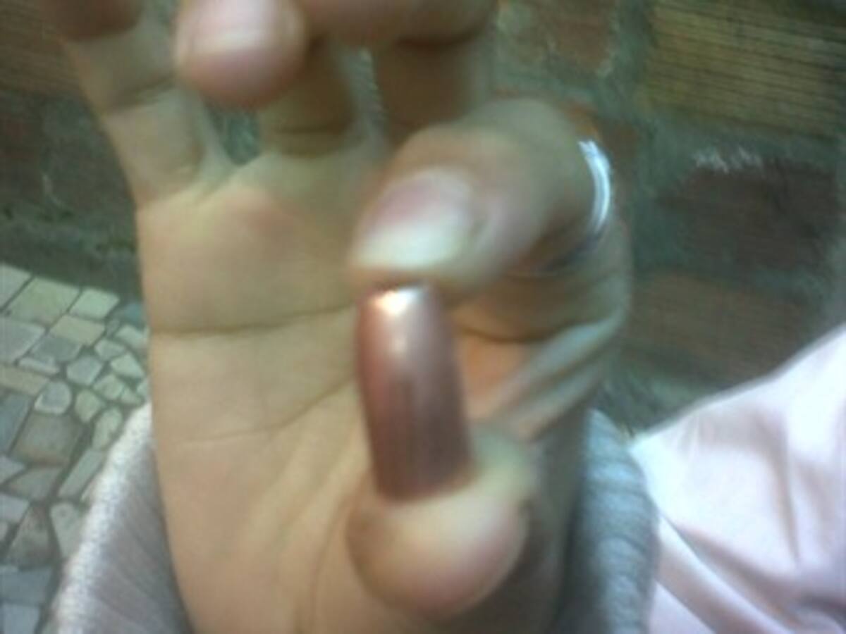 Niña resultó herida en nuevo caso por bala perdida