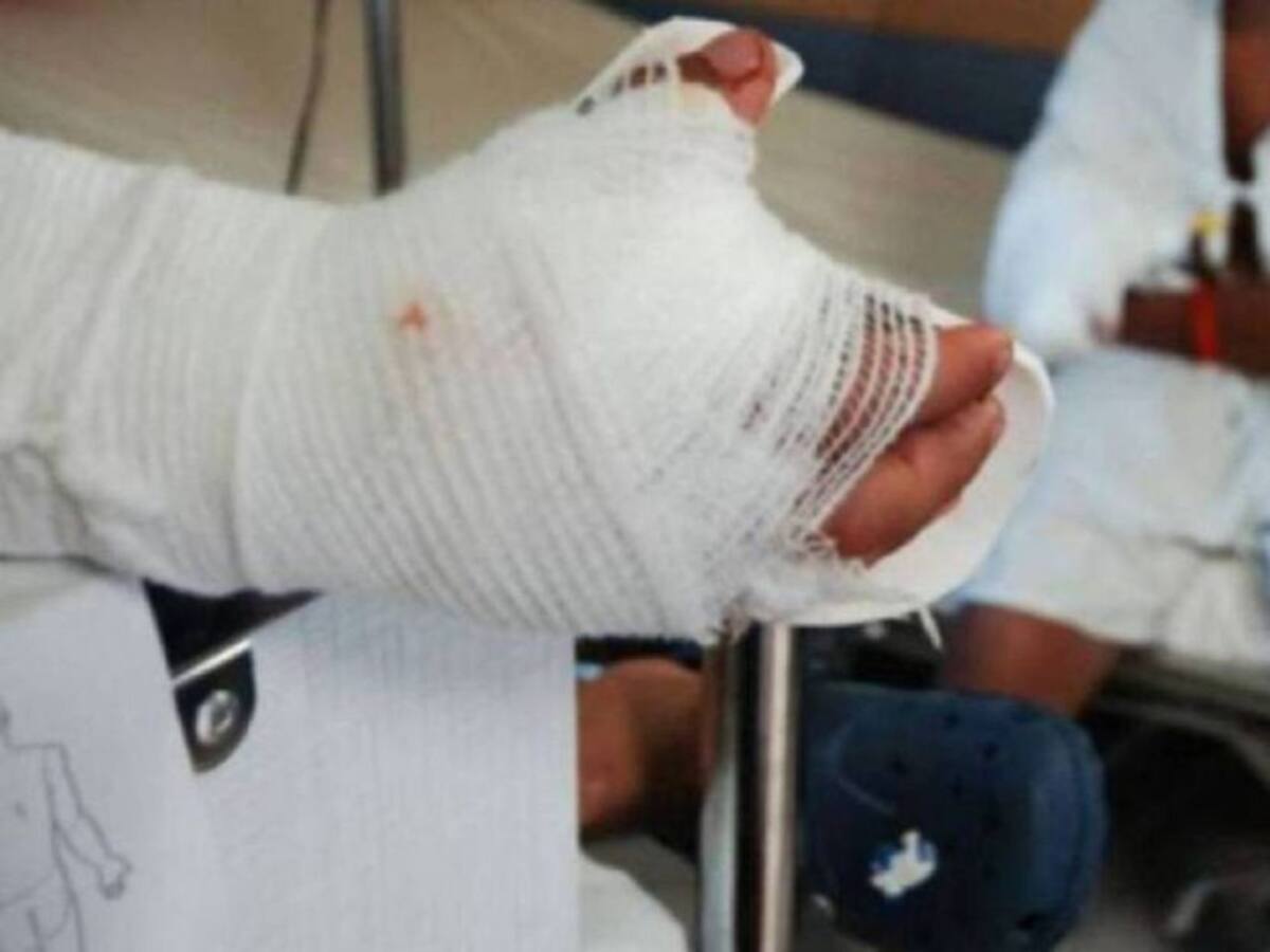 Alias “Charol” les prendió fuego a los habitantes de calle: Policía