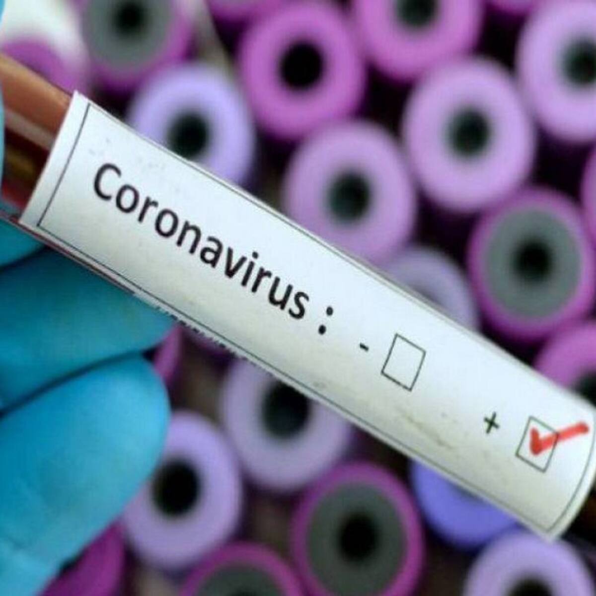 Denuncias por demoras en entrega de resultados de pruebas Covid-19 en Cali