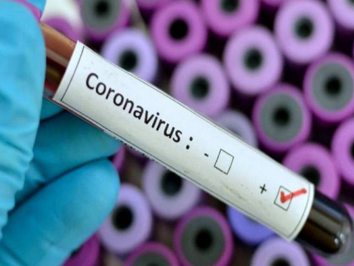 Denuncias por demoras en entrega de resultados de pruebas Covid-19 en Cali