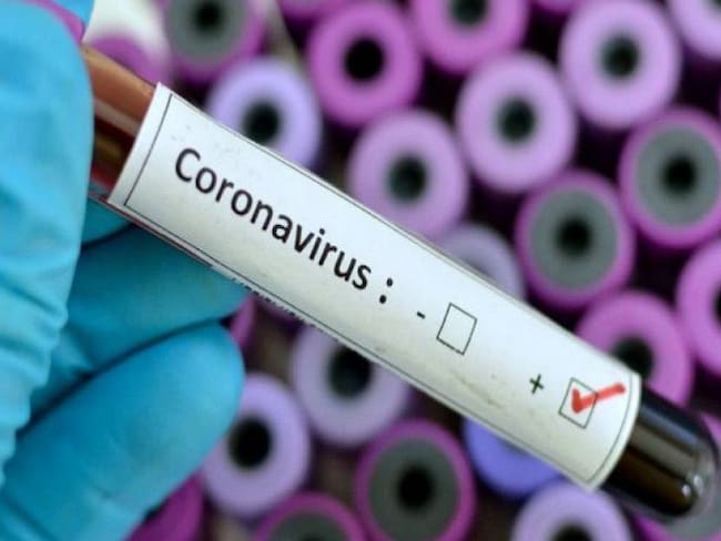 Denuncias por demoras en entrega de resultados de pruebas Covid-19 en Cali