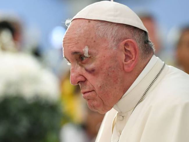 Papa Francisco pidió que la ONU ayude a Venezuela