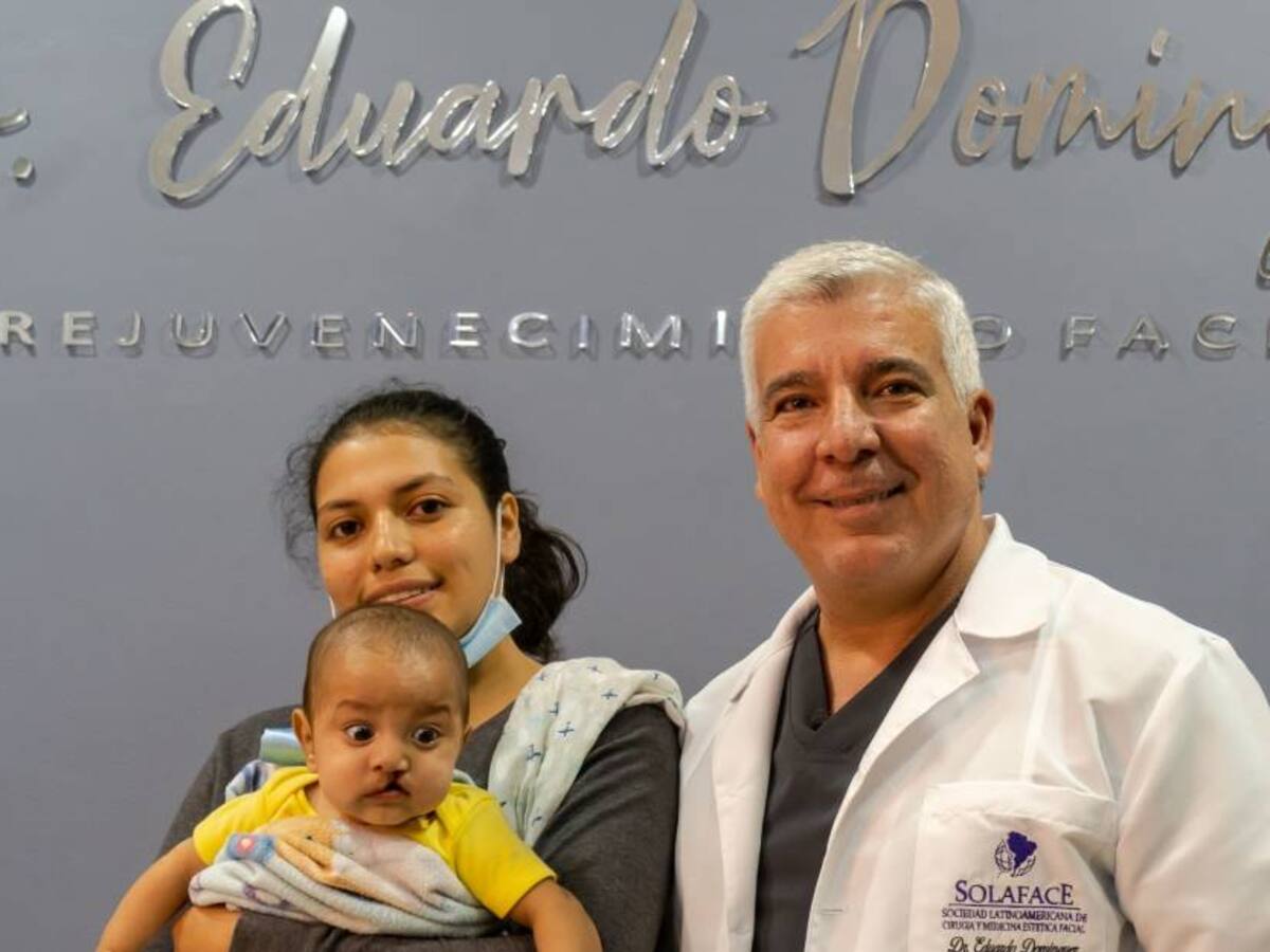 Más de 100 niños con labio y paladar hendido podrán recibir tratamiento gratis