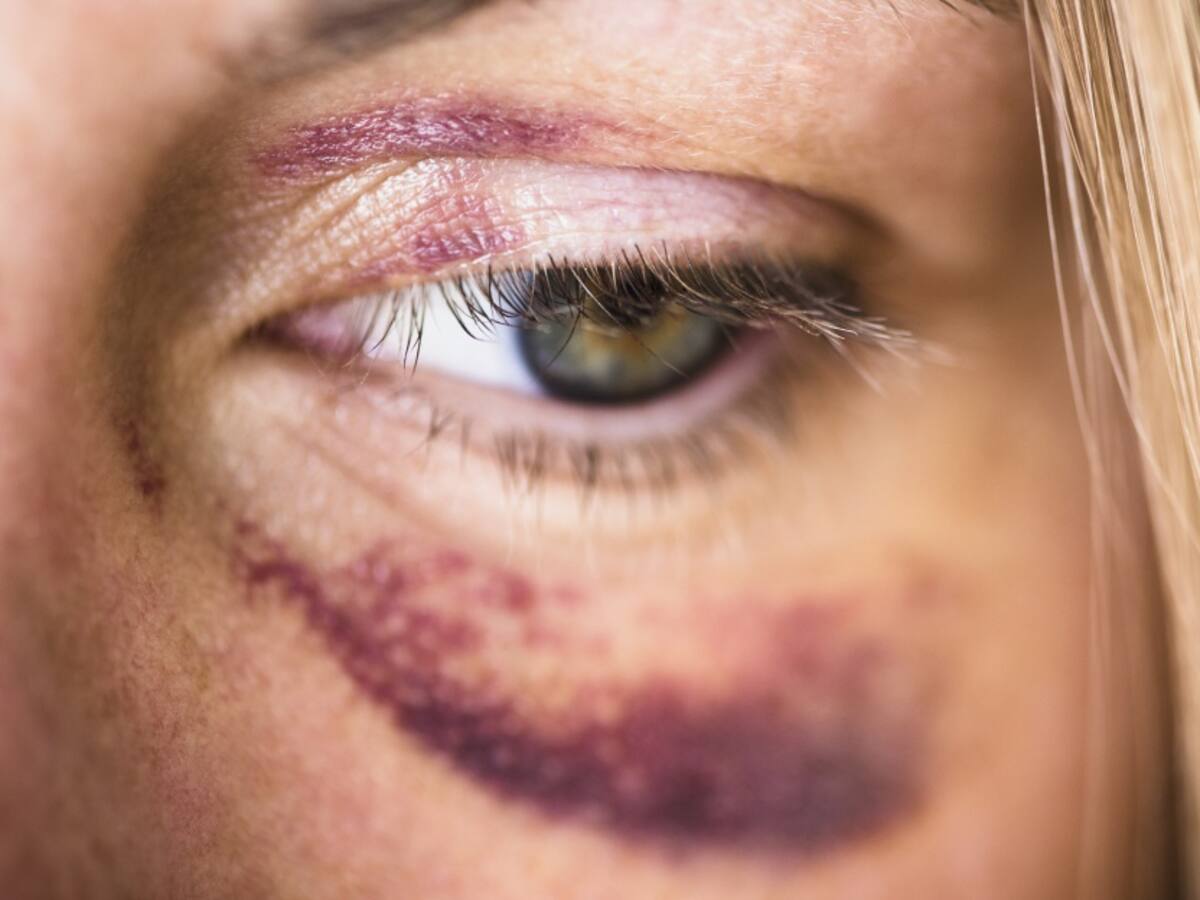 El drama de las mujeres víctimas de violencia intrafamiliar en Soacha