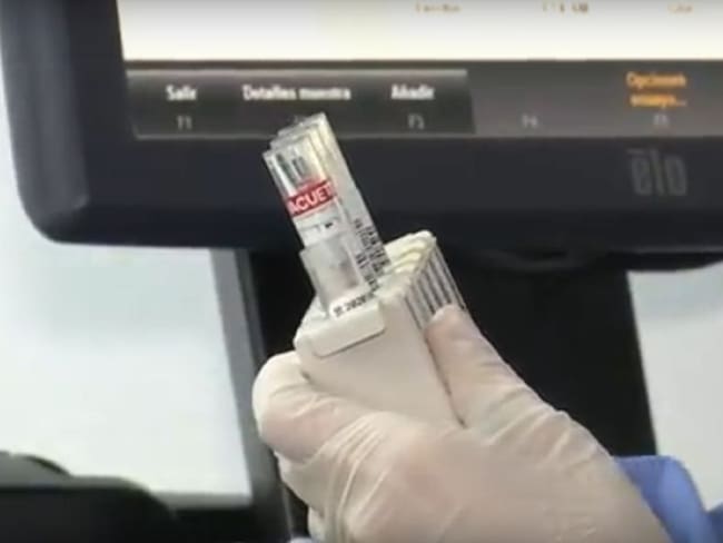 144 personas han participado del estudio para la vacuna contra la COVID-19